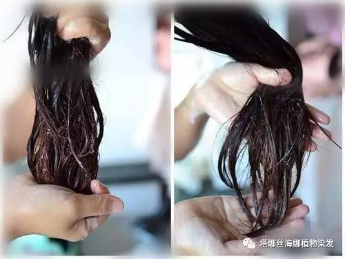夏季头皮经常痒怎么办？美发护发小技巧告诉你